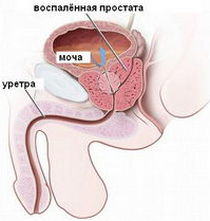 prosyvosp