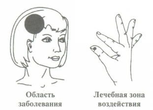 golova